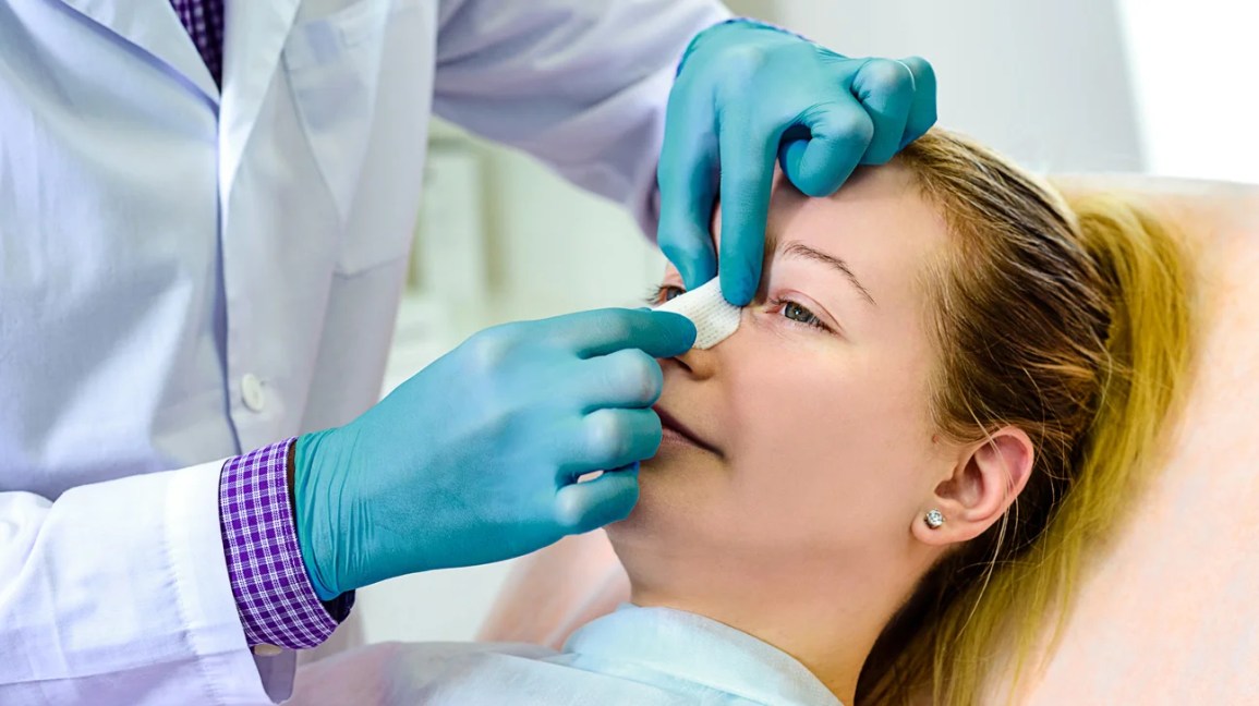 Rhinoplasty görseli