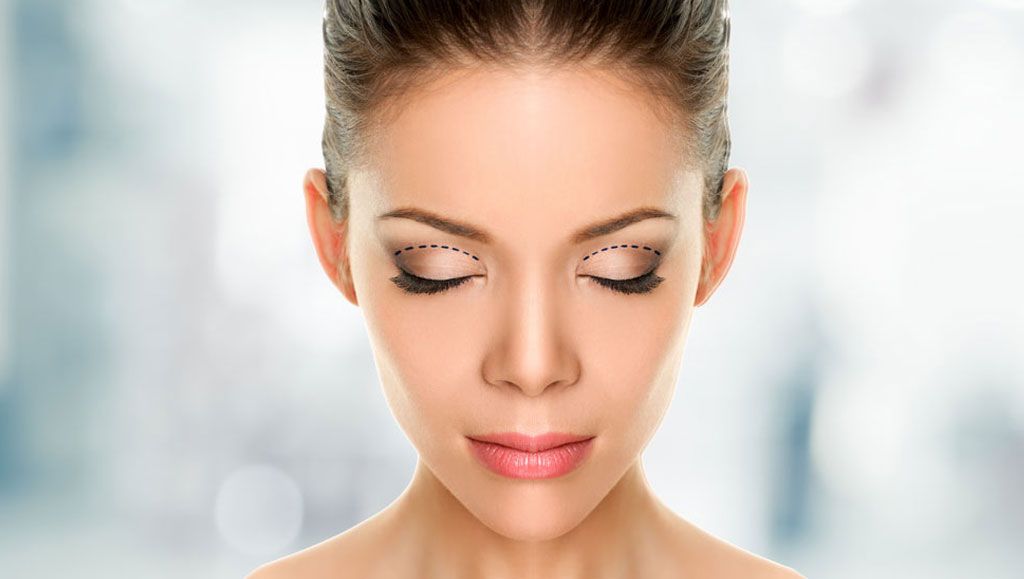 Rhinoplasty görseli